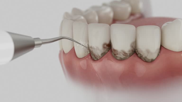 Reliable Dental Implants contractor in Tappahannock, VA by Smile Center Dentistry